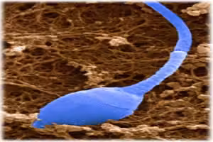 espermatozoide