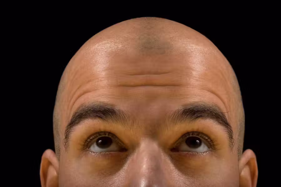 careca|careca_2