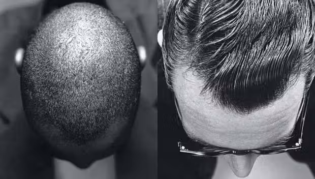 cabelo_vitaminas