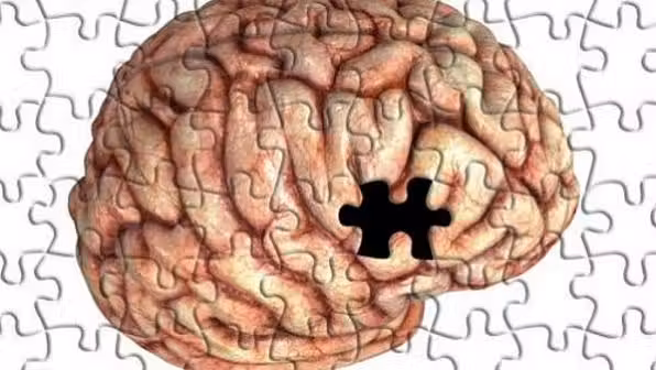 Cerebro-Falta-Alzheimer-size-598