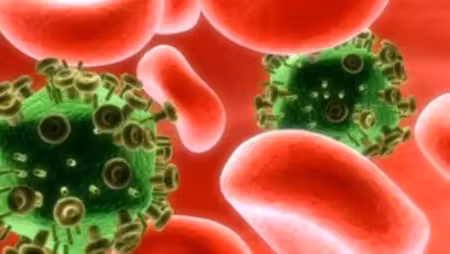 expulsar_hiv