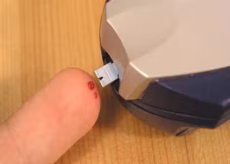 Verificar a gligose, parte do dia a dia do diabetico. Foto: Reprodução