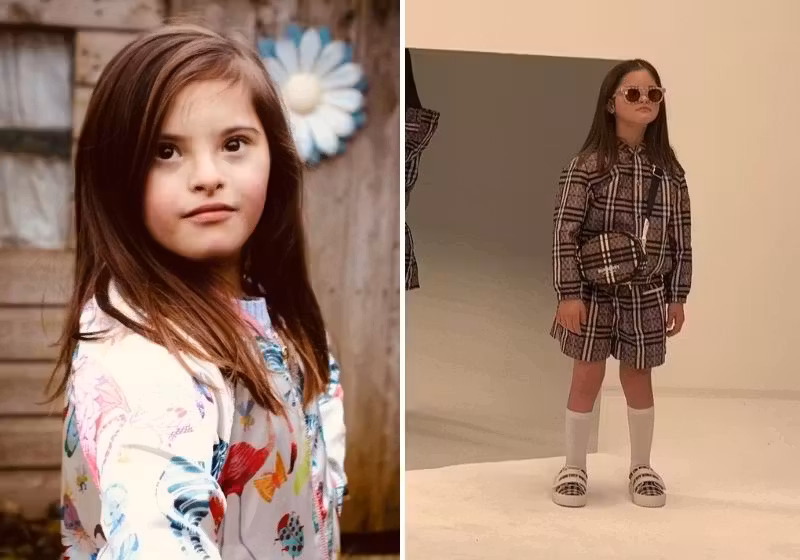 Roni Littman, de 9 anos, é a mais nova modelo com síndrome de Down da grife britânica Burberry - Foto: @ronilittman_zebedee