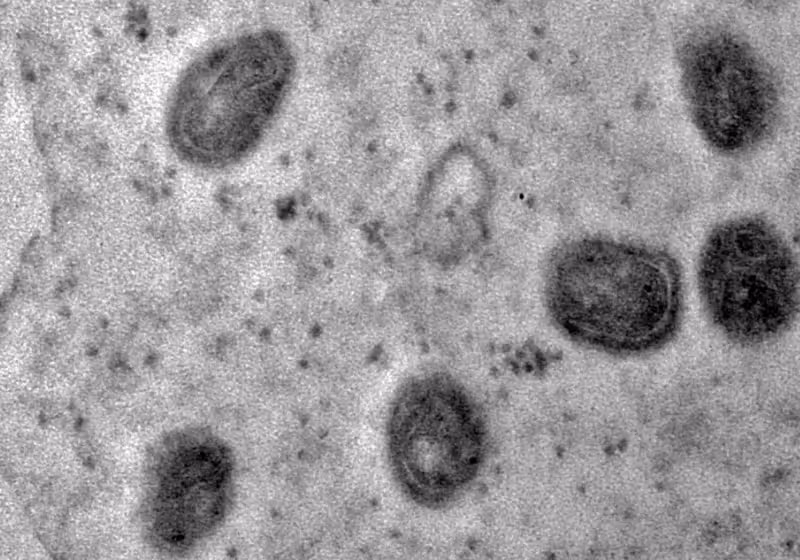 O genoma do vírus monkeypox pôde ser analisado melhor após o registro da Fiocruz - Foto: reprodução Fiocruz