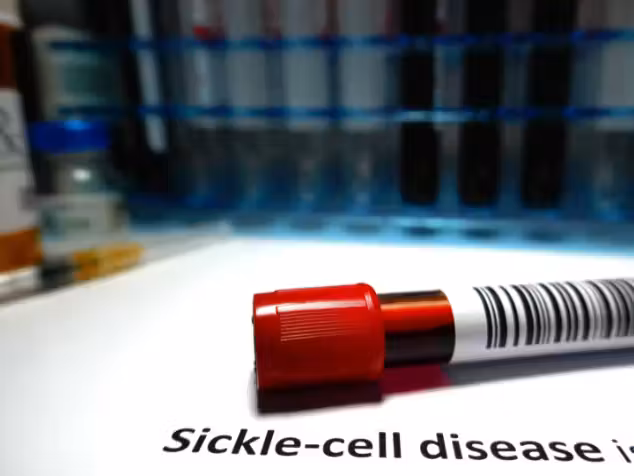 Os novos tratamentos aprovados pelos Estados Unidos podem oferecer cura para pacientes com anemia falciforme. - Foto: reprodução/Hailshadow/Getty Images.