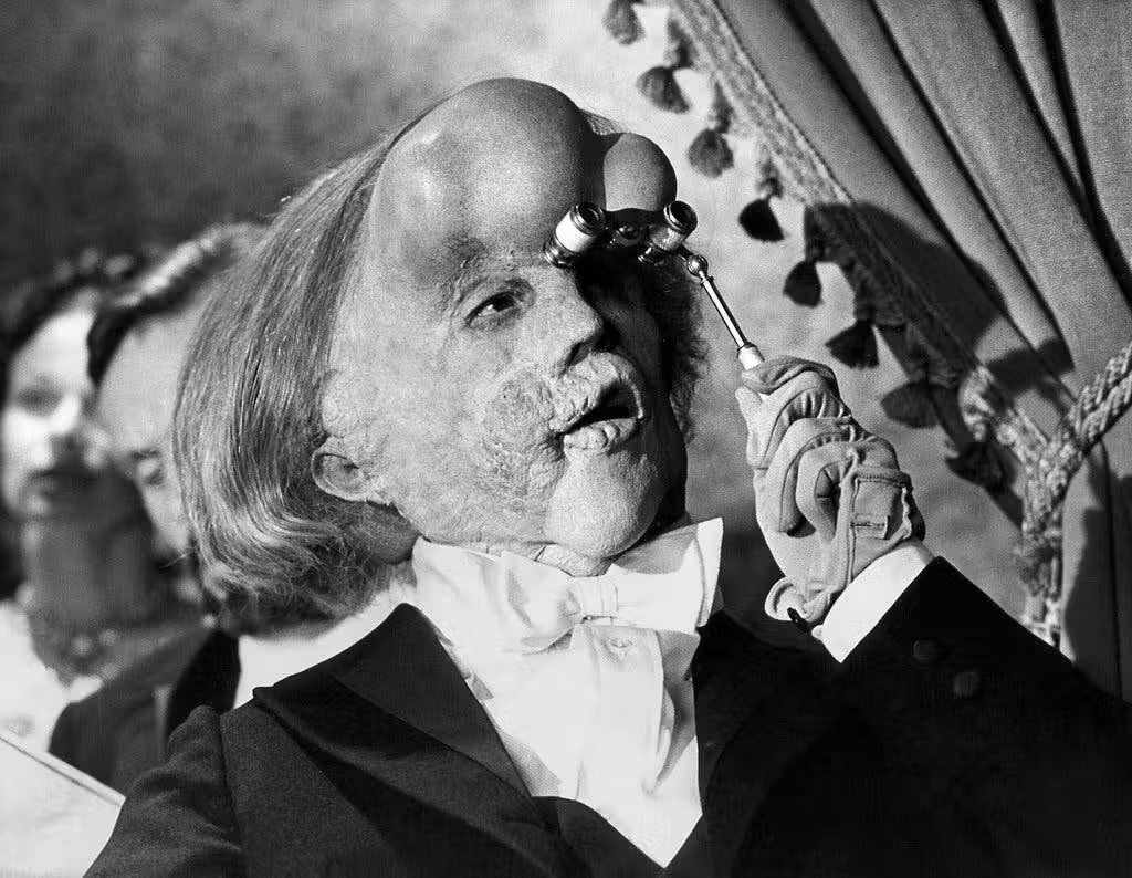 The Elephant Man foi um grande sucesso dos anos 80. Foto: The Elephant Man