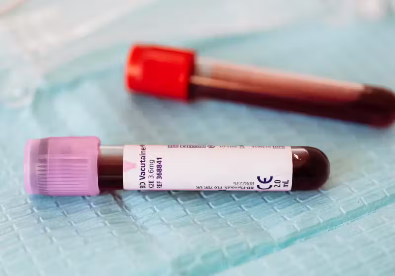 O sangue artificial desenvolvido pelo Japão já foi testado em animais e agora será avaliado em humanos ainda este ano. - Foto: Canva