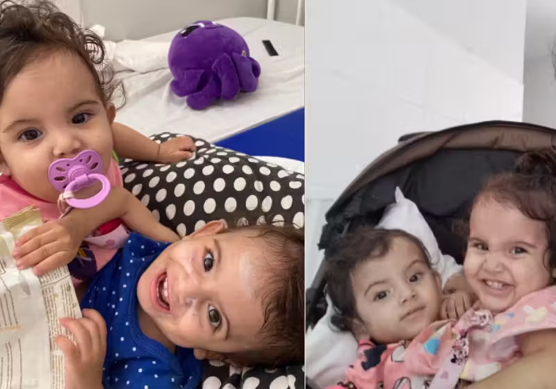Kiraz e Aruna, as gêmeas siamesas de 1 ano e meio, passaram por uma cirurgia de 15 horas em Goiás para serem separadas, com tudo pago pelo SUS. Mais de 60 profissionais envolvidos. - Foto: @kirazaruna
