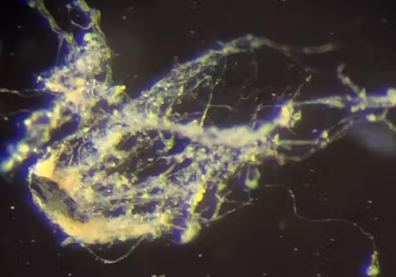 A bactéria batizada de Candidatus Electrothrix yaqonensis, é conhecida como bactéria-cabo: um micróbio em formato de bastonete, conectado a outros em ambas as extremidades, formando uma cadeia, e que compartilha uma membrana externa que dá origem a vários filamentos.