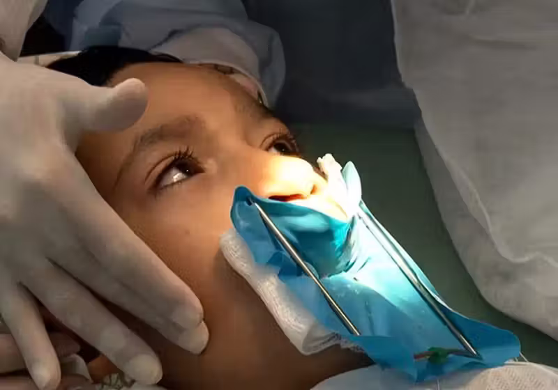 A lei que garante a cirurgia para lábio leporino no SUS foi sancionada na quarta (7). - Foto: TV Brasil