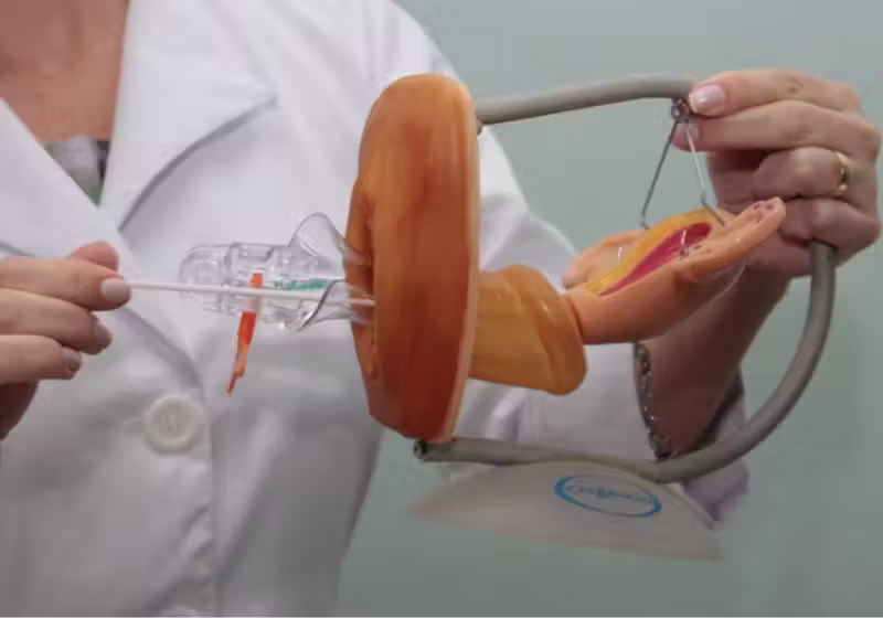 O Teal Health (feito com empatia) é menos invasivo do que o Papanicolau também ser um autoexame, a própria mulher coleta o material, no caso dos EUA, ela poderá enviar pelo Correio. Foto: Cofen