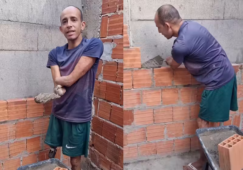 Homem mostra toda superação após perder as duas mãos e uma perna devido choque de alta tensão. Ele sonha com próteses. - Foto: reprodução redes sociaiis