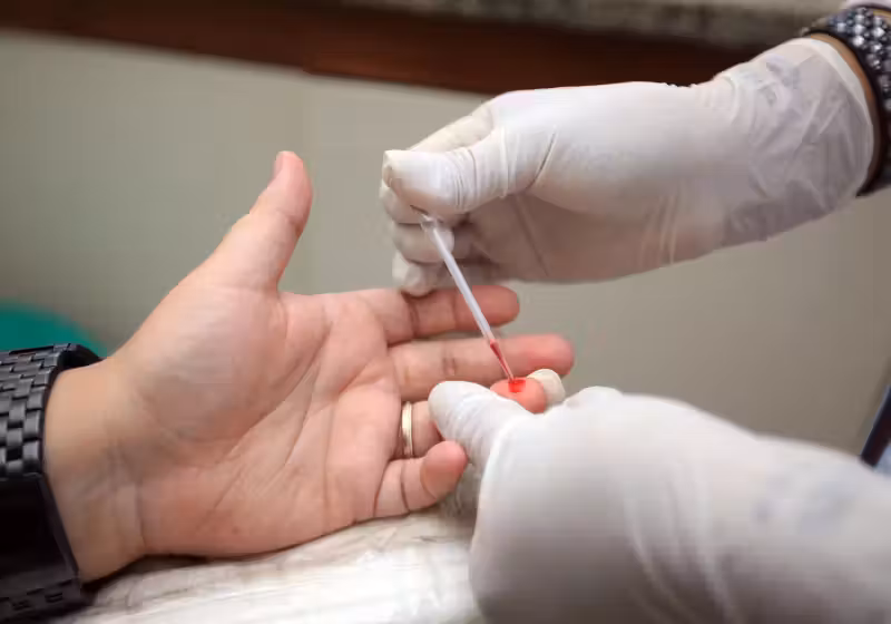 A descoberta de cientistas da Austrália, que pode levar à cura do HIV, consegue entrar nas células infectadas, o que era inviável antes. - Foto: Márcio Ferreira/Agência Pará