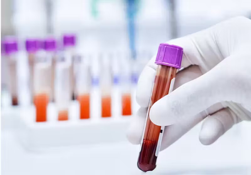 O novo exame de sangue deve ajudar pacientes com câncer a conseguir tratamentos e diagnósticos mais rápidos para iniciar as terapias. - Foto: kukhunthod/iStock