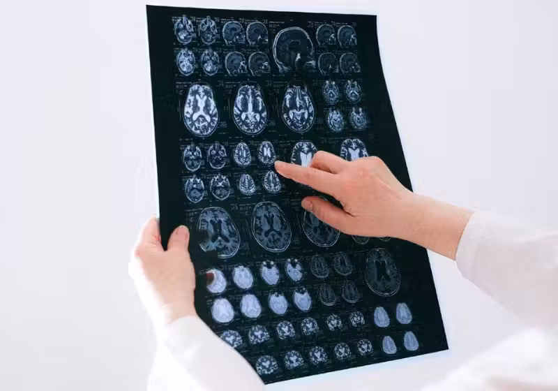 Cientistas da Austrália revertem sintomas de Parkinson em camundongos após descoberta de uma nova proteína. - Foto: Anna Shvets