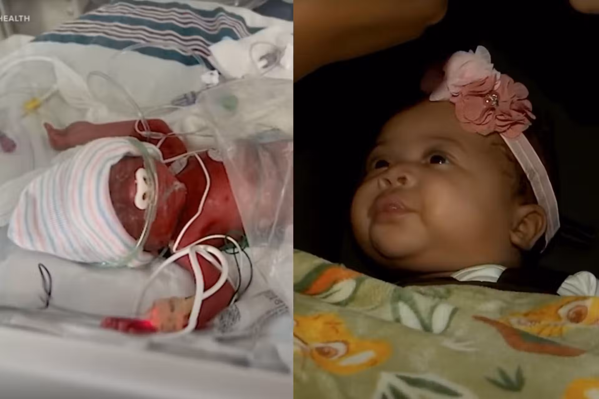 Trinity, a microbebê que nasceu com apenas 450 gramas, venceu e teve alta da UTI Neonatal após 5 meses de internação nos EUA. - Fotos: Catholic Health, ABC7NY