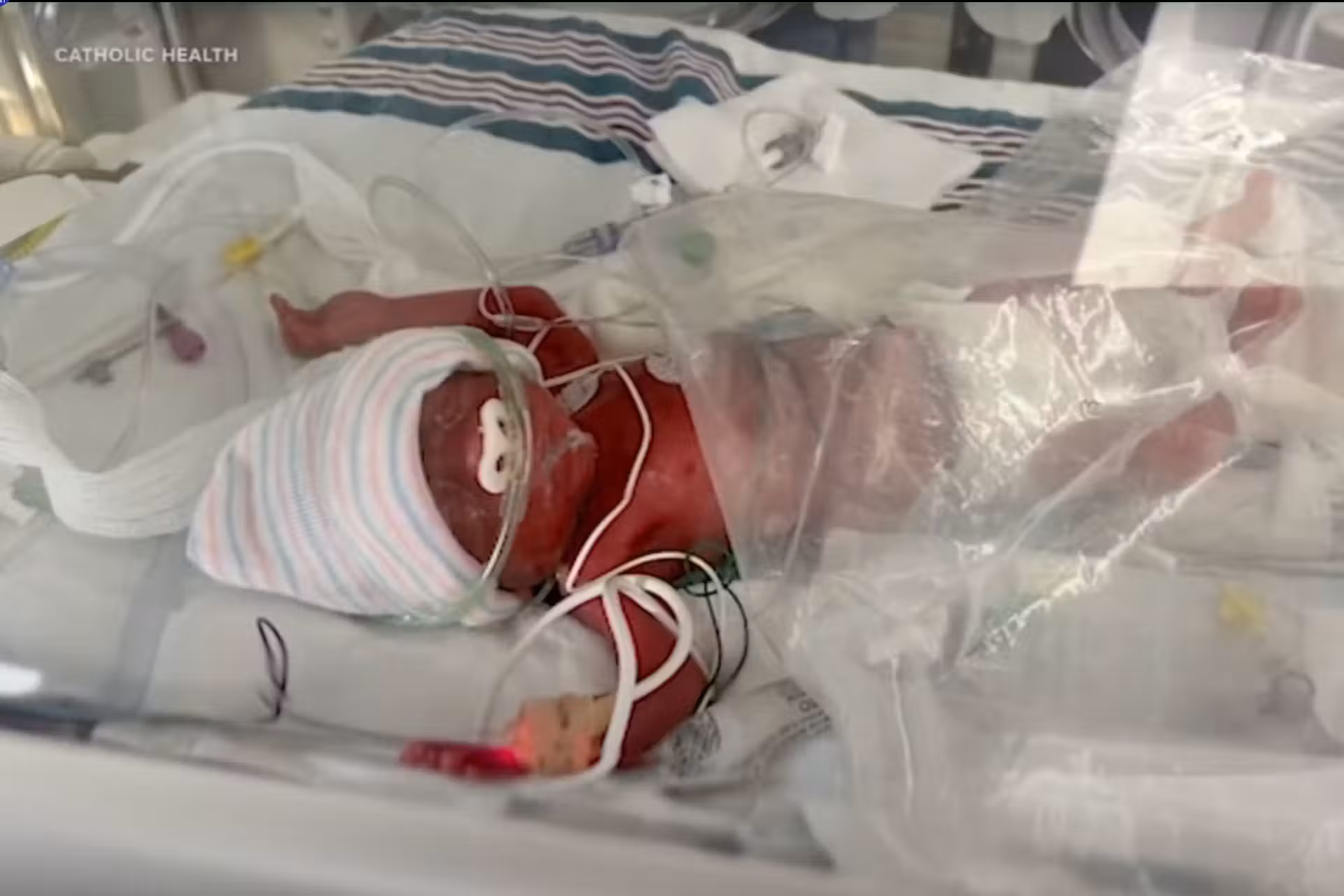 Trinity, a micro bebê, quando que nasceu em abril com apenas 450 gramas. - Foto: Catholic Health, ABC7NY