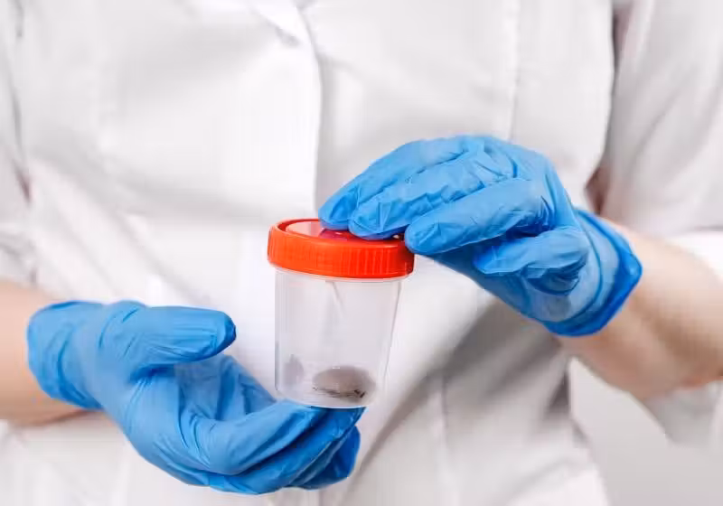 O novo teste de cocô criado na Suíca para detectar câncer de cólon se mostrou indolor, barato e eficaz no diagnóstico. - Foto: Instamed