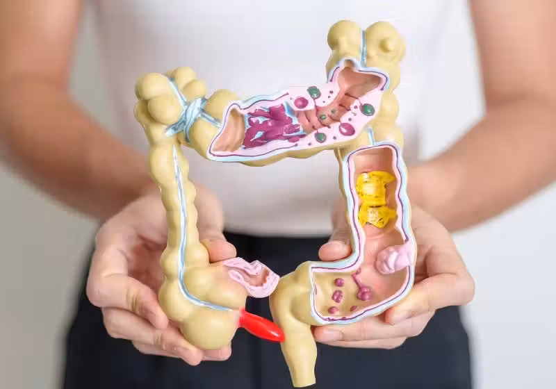 O novo teste para câncer de cólon utiliza fezes para identificar a doença e se mostrou eficaz nos diagnósticos - Foto: Canva