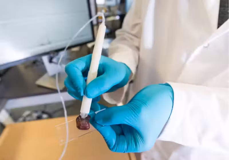 A caneta que ajuda a detectar câncer, através de um teste rápido, foi criada pela química brasileira Lívia Schiavinato Eberlin. - Foto: Vivian Abagiu/Universidade do Texas