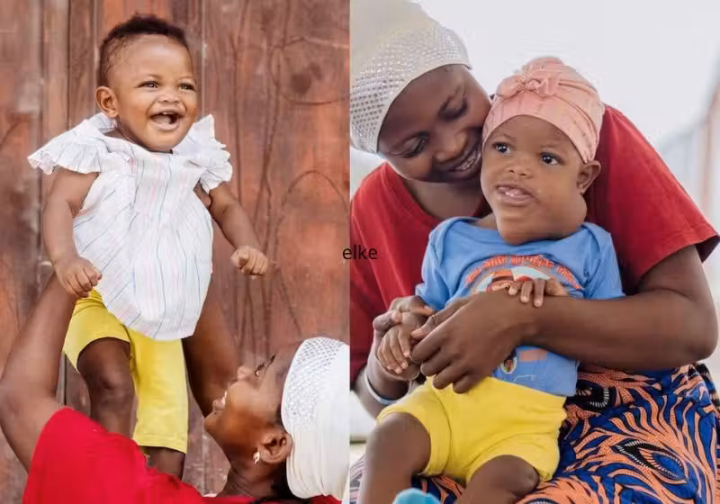 O cirurgião retirou de graça o tumor gigante da criança de 10 meses, que ia do pescoço até o rosto dela. A cirurgia foi no hospital a bordo do Global Mercy, atracado em Serra Leoa. - Fotos: SWNS / Mercy Ships