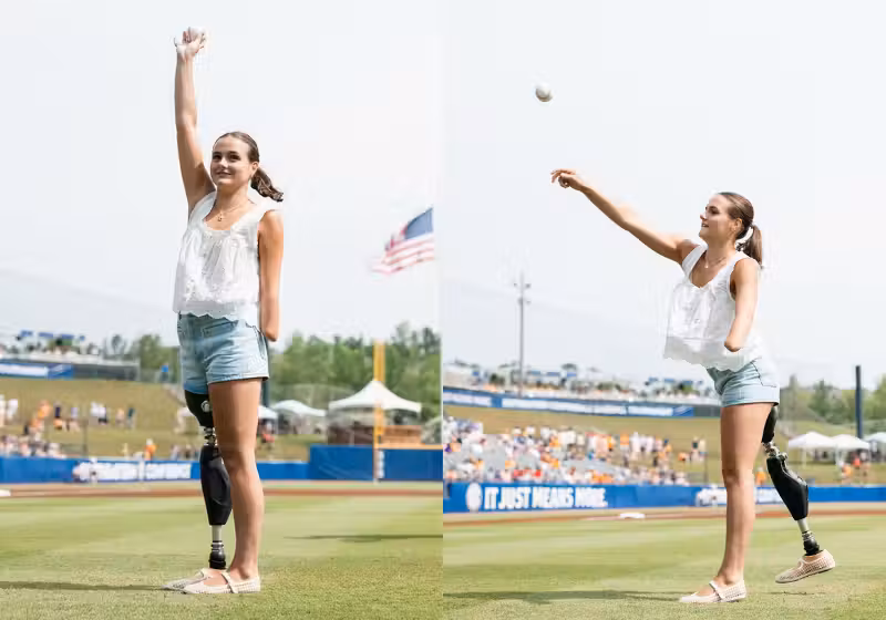 A adolescente Lulu Gribbin sofreu um ataque de tubarão em 2024 e hoje se prepara para disputar as paralimpíadas - Foto: Instagram
