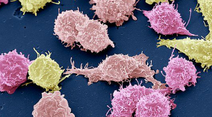cancer-cells2