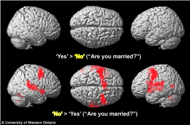 cerebro_yes|cerebro_yes_2