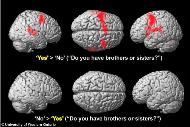 cerebro_yes_2
