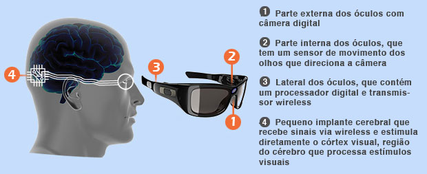 olho_bionico_monash_2