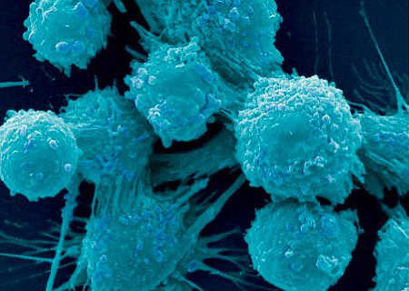 Pesquisadores japoneses desenvolvem experiência que mata células do câncer. Foto: Reprodução