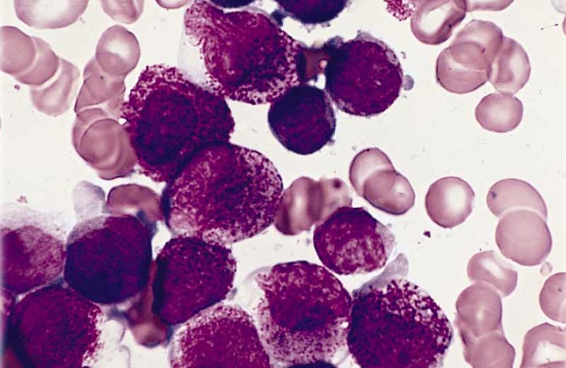 Foto: WikiMediaCommons