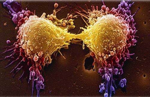 Experiência busca destruir células e curar o câncer. Foto: SPL