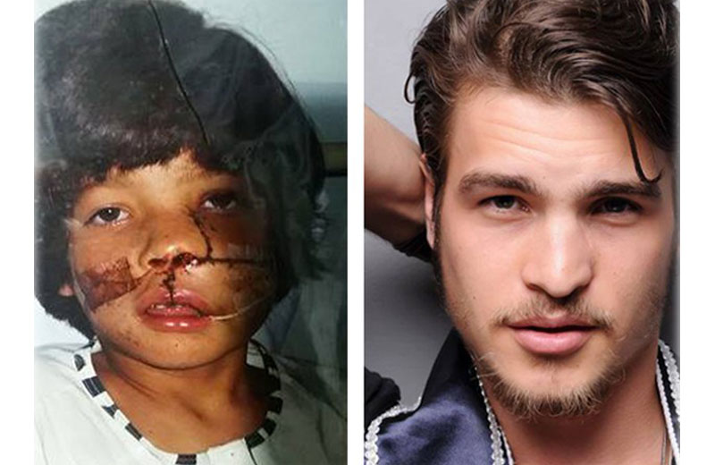 Fotos: arquivo pessoal