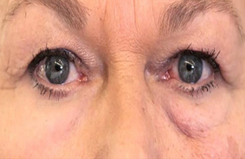 Foto: Reprodução YouTube