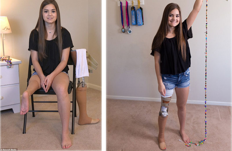 Foto: Barcroft Media