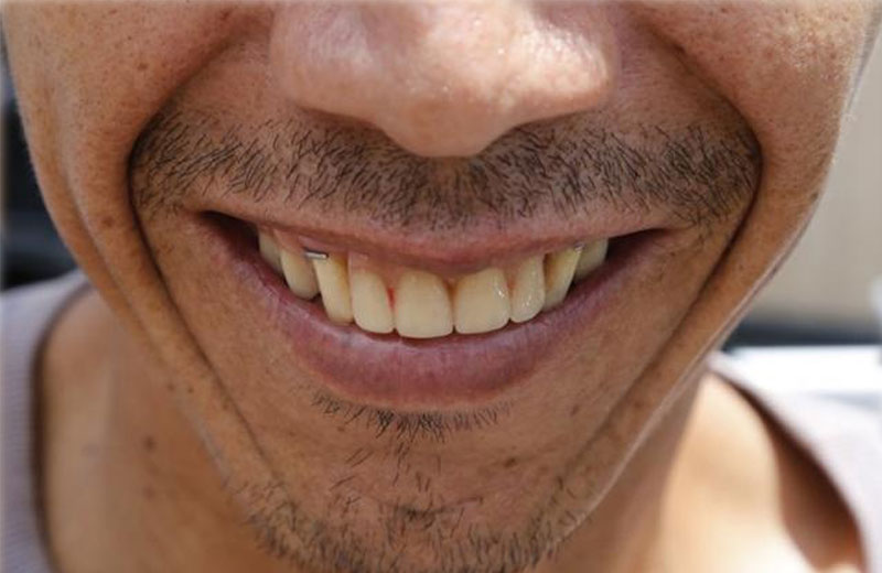 Foto: CampoGrandeNews||Fotos: CampoGrandeNews||