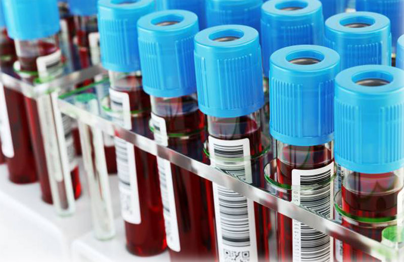 Foto: iStockphoto/Getty Images