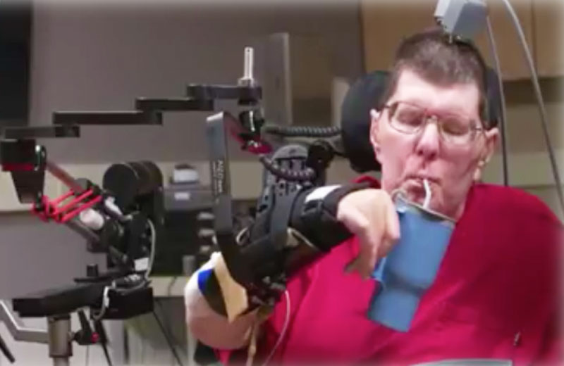 Foto: reprodução / AMCTV / Case Western Reserve University / Cleveland FES Center