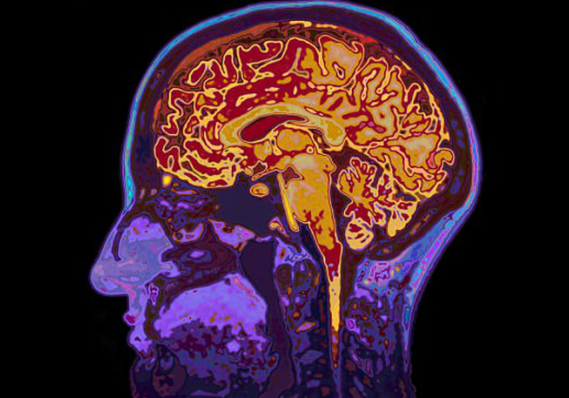 Foto: Shutterstock - Ressonância Magnética -mostra o fluxo sanguíneo