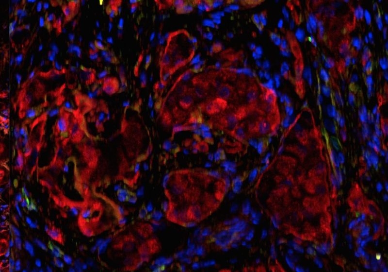 Ilhotas de omento transplantado/Foto: Diabetes Research Institute / Universidade de Miami Miller School of Medicine