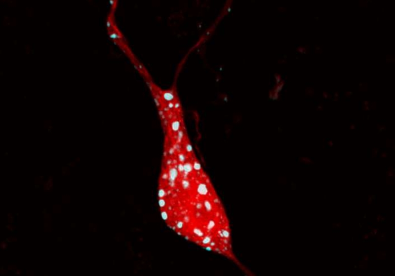 Foto: Imagem Neurônio em sinapse/Daniel Knowland e Byungkook Lim