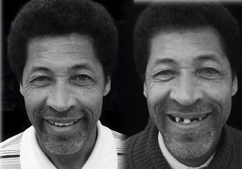 Seu José - Fotos: Projeto Conexão Saúde