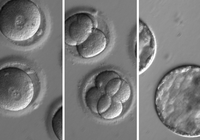 Desenvolvimento de embriões após injeção de uma enzima de correção de genes e esperma de um doador com uma mutação genética conhecida por causar cardiomiopatia hipertrófica. Foto: Nature/OHSU