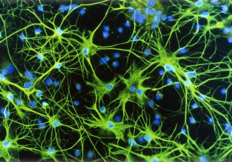 Neurônios - Foto: Latinstock