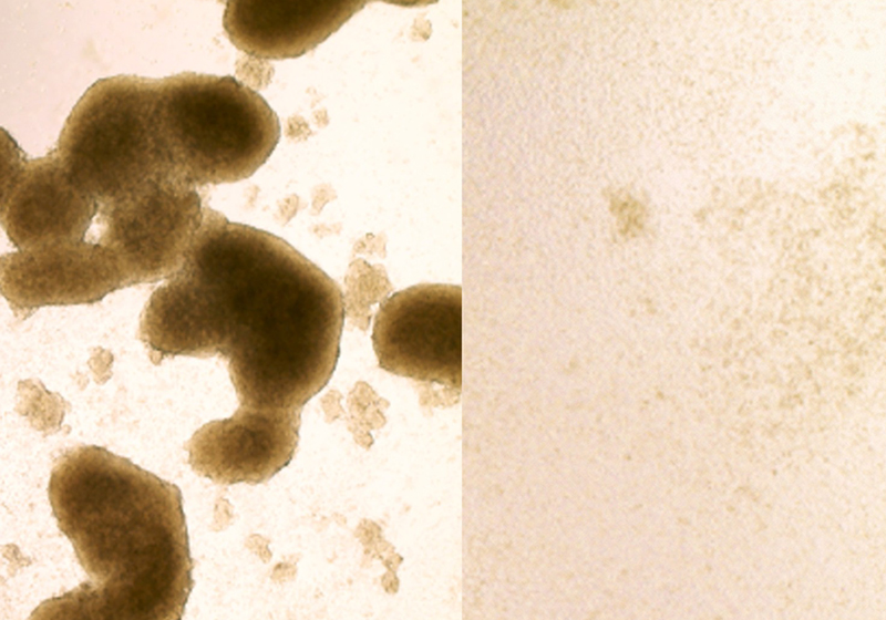 Imagem da direita mostra células após o tratamento com Zika Foto: Zhe Zhu