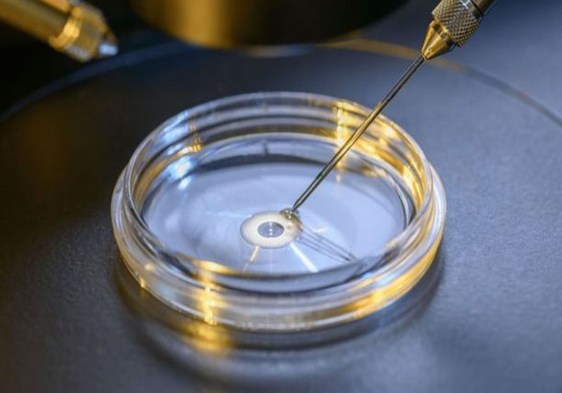 Foto: Getty Images/ BBC