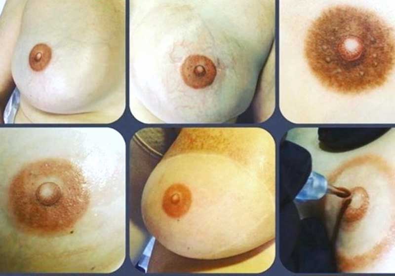 Foto: Cleison Leite/Arquivo pessoal