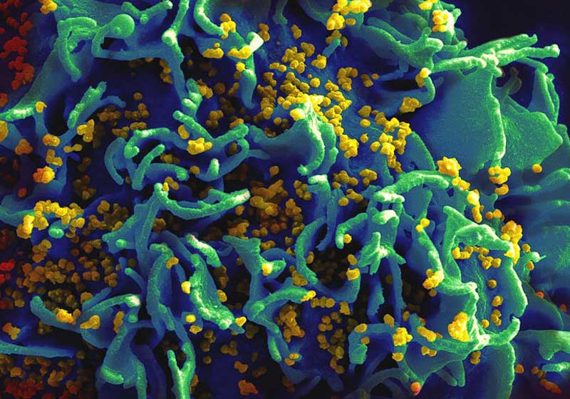 Foto: National Institutes of Health - NIH / Wikimedia Commons