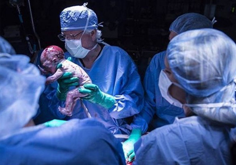 Bebê nasce após transplante de útero - Foto: divulgação / Centro Médico da Universidade Baylor